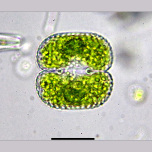 Afbeelding van Nieuwe algensoort ontdekt: Sieraad van het Zwanenwater