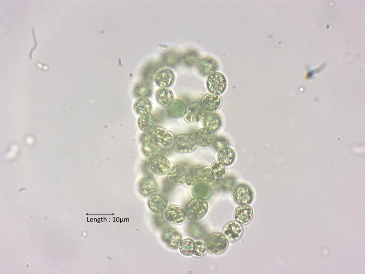 Anabaena spiroides