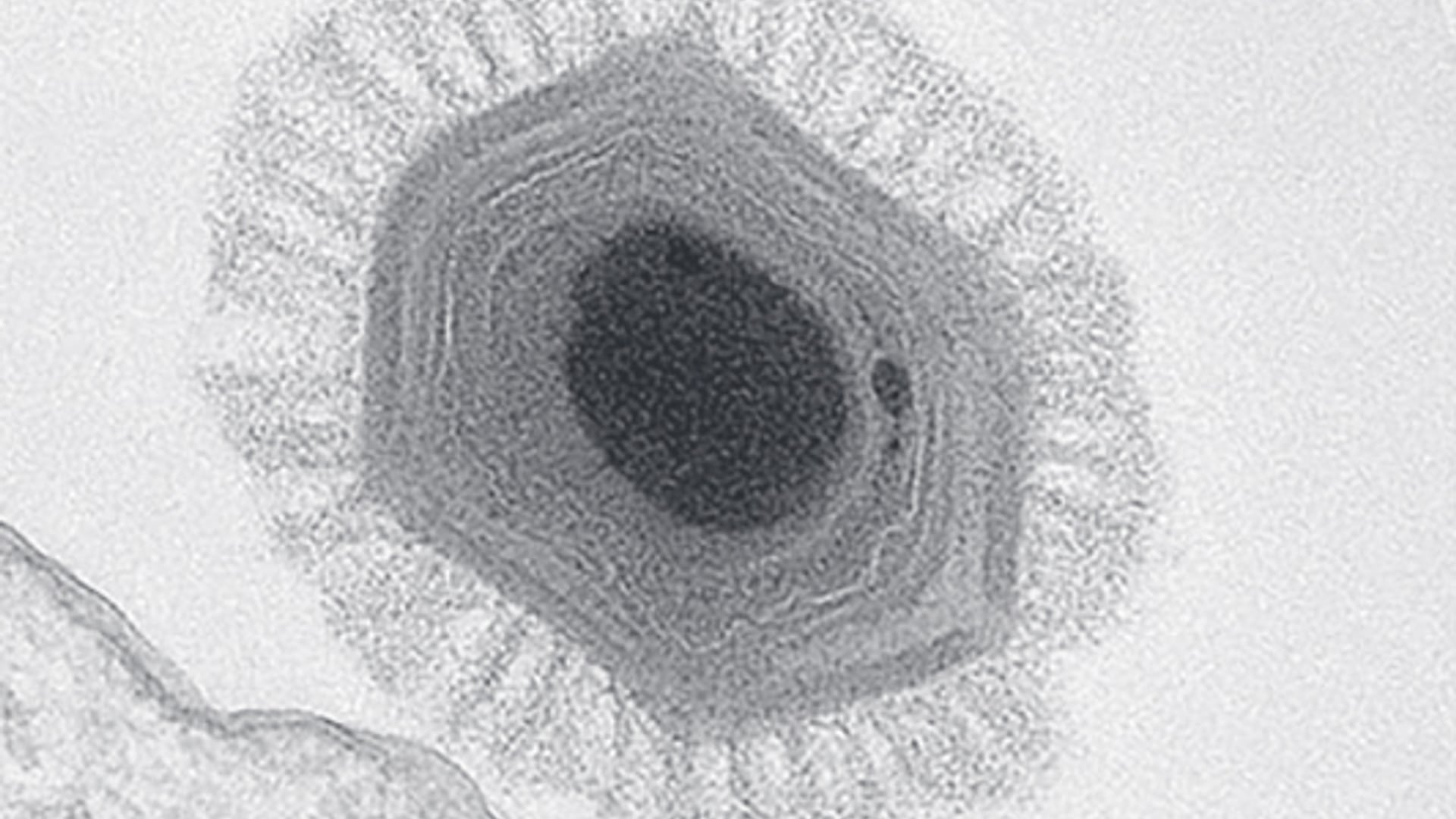 virus.jpg