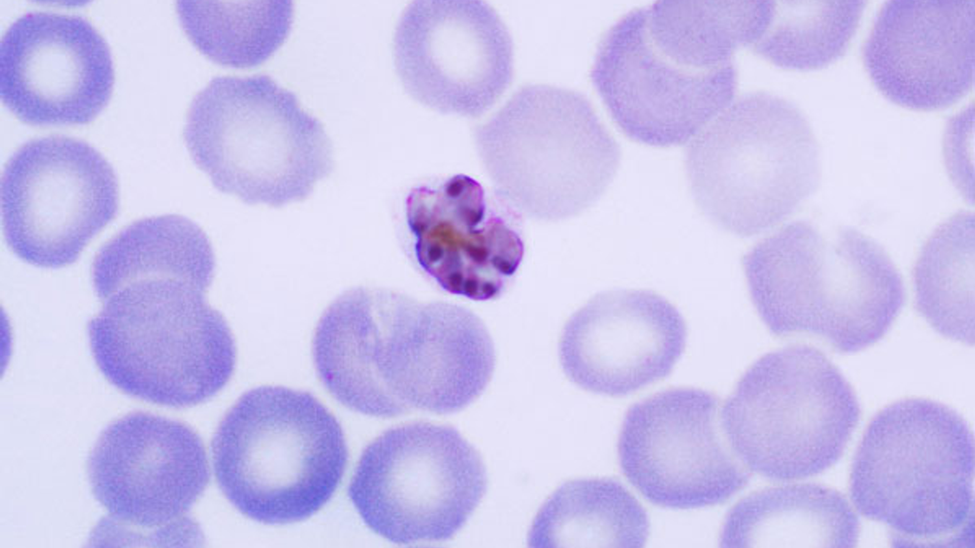 malaria.jpg