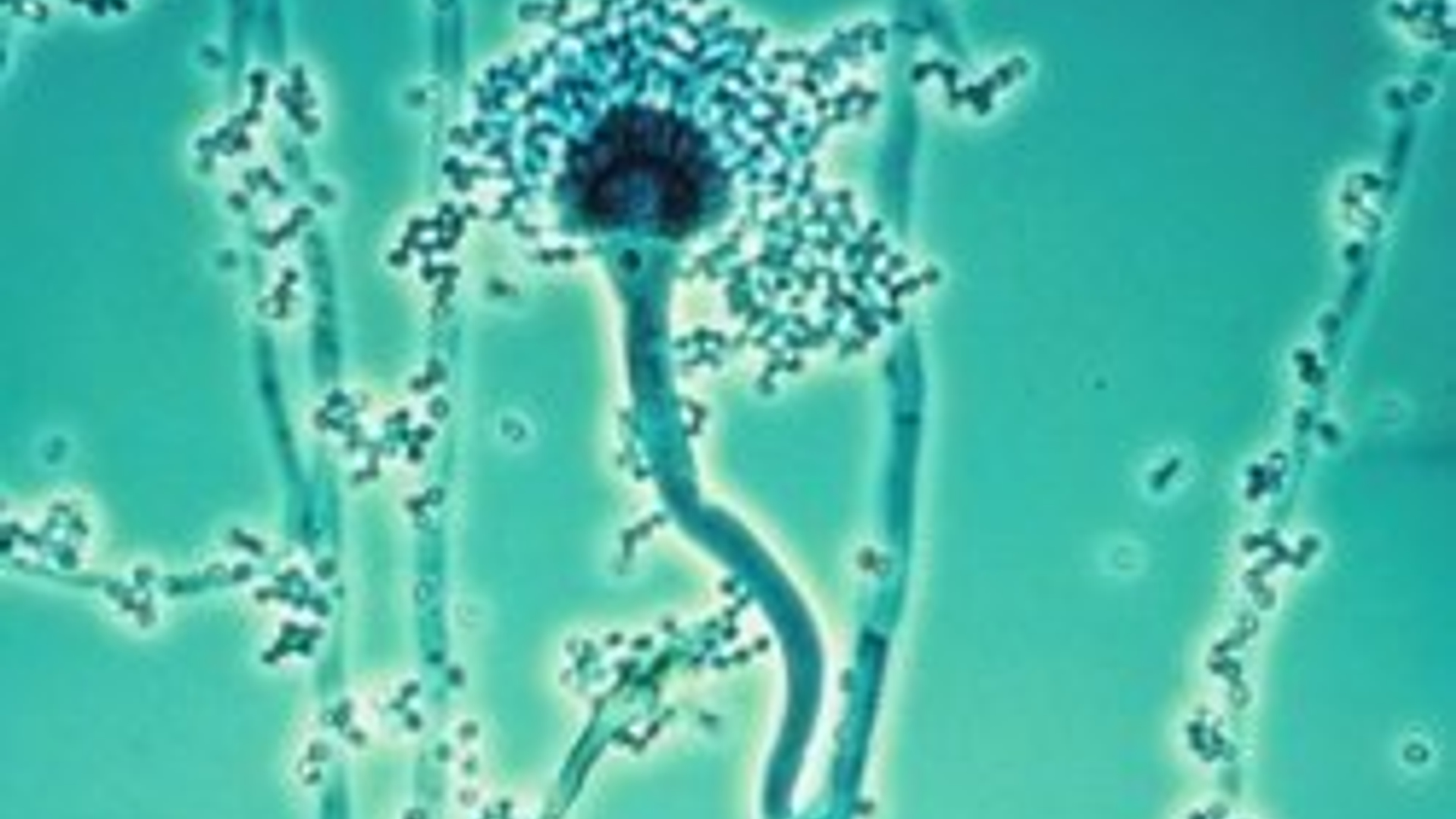 aspergillus.jpg